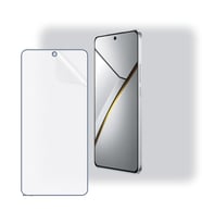 SChitec Realme Neo7 Uyumlu Ön Yüzey Nano Şeffaf Hidrojel Ekran Koruyucu