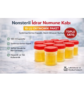 Nonsteril İdrar Numune Kabı 100 Ml Sızdırmaz Kapaklı Steril Olmayan Numune Kabı Laboratuvar Kullanı
