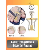 #Tırnak Ayak Tırnağı Batma Düzeltici Aparat Düzeltici Evde Kolay Pratik Batık Tırnak Bakım Aleti