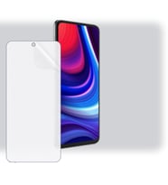 SChitec Omix X500 Uyumlu Ön Yüzey Nano Şeffaf Hidrojel Ekran Koruyucu