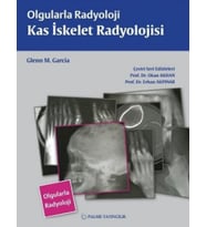 Olgularla Radyoloji Kas İskelet Radyolojisi (Krem)
