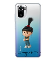 Xiaomi Agnes Tasarımlı Şeffaf Telefon Kılıfı