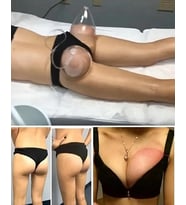 Göğüs Kalça Büyütme Ve Meme Geliştirme Masaj Vakumlu Emiş Gücü Yüksek Göğüs Büyütücü Pompası 11cm 11cm