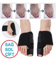 Halluks Valgus Gece Ateli Hallux Valgus Düzeltici Tedavi Ayak Başparmak Kemiği Çıkıntısı Bunyonu (Siyah)