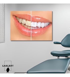 Tekli Yatay Kanvas Diş Sağlığı Poliklinik Tablo Dekoratif Diş