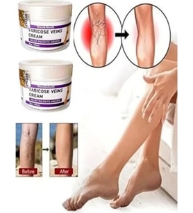 Süper V.ricose And Spider Vns Sthing Leg Cream 100 ml x 2 Adet