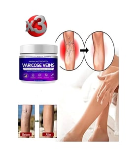 Maximum Strength Varicose Veins Bakım Kremi 100 ml x 3 adet