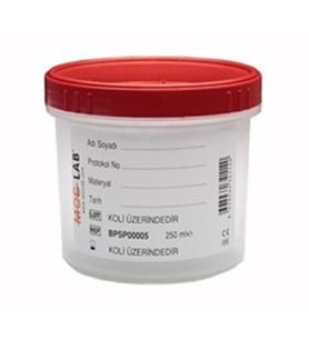 Patoloji Numunesi Saklama Kabı 500 ml Spesmen Kabı (10 adet ürün içindir)