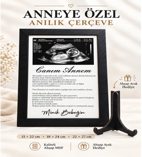 Bir Fotoğraftan Daha Fazlası… Bir Ömür Saklanacak Bir Anı Canım Annem