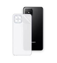 SChitec HONOR Play 5 5G Uyumlu Arka Yüzey Hidrojel Koruyucu Film