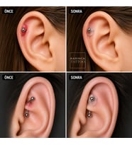 Piercing Keloid Diski Bump Piercing Yara Önleyici Bioplast (10 ADET)