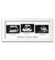 Bebek Ultrason Fotoğraf Çerçevesi 3'lü Triemester, Sonogram Anı Çerçevesi, Yeni Anne Hamile Hediyesi (Beyaz)