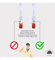 Tek Kullanımlık Test Kiti 1 Adet