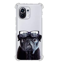 PrintiFy Xiaomi Mi 11 Uyumlu Köpek 3 Baskılı Şeffaf Köşe Korumalı Antişok Kılıf