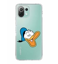Xiaomi  Mi 11 Lite  Kamera Korumalı Kapak Donald Duck Tasarımlı Şeffaf  Kılıf