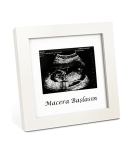 Bebek Ultrason Fotoğraf Anı Çerçevesi, Yenidoğan İlk Fotoğrafım Resim Hatırası, Baby Shower Hediyesi (Parlak Beyaz)
