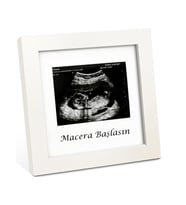 Bebek Ultrason Fotoğraf Anı Çerçevesi, Yenidoğan İlk Fotoğrafım Resim Hatırası, Baby Shower Hediyesi (Parlak Beyaz)