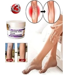 Süper V.ricose And Spider Vns Sthing Leg Cream 100 ml x 3 Adet