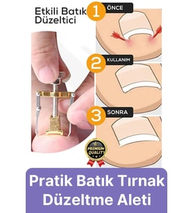 #Tırnak Kolay Bakım Orijinal Çelik Batma Ağrıyı Azaltan Düzeltme Aleti Batık Tırnak Çıkartıcı Aparat