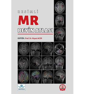 Resimli MR Beyin Atlası