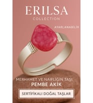 Sertifikalı Doğal Pembe Akik Taşı Yüzük – Ayarlanabilir Kalın Tımbıl Kasa (Çok Renkli)