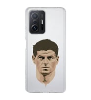 Xiaomi Mi 11T - 11T Pro Uyumlu Steven Gerrard Tasarımlı Şeffaf Telefon Kılıfı