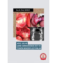 Ağız Diş ve Çene Cerrahisinde Kist ve Tümör Benzeri Lezyonlar