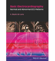 Basic Electrocardiography: Normal And Abnormal Ecg Patterns
