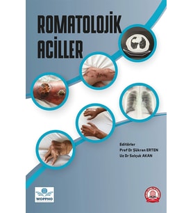 Romatolojik Aciller