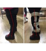 Karma Grup Ortopedi Genu Rekurvatum Dizlik İsveç Diz Ortezi BÜKÜLEBİLİR.(3XL BEDEN - - DİZ ÇEVRE ÖLÇÜSÜ 50-56 CM YETİŞKİN BEDENİ)