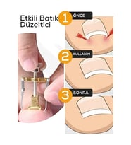 Batık Tırnak Çıkartıcı Orijinal Çelik Batan Tırnağı Düzeltme Aparatı Düzeltici Aleti Çıkarıcı Aparat
