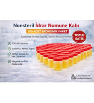 Nonsteril İdrar Numune Kabı 100 Ml Sızdırmaz Kapaklı Steril Olmayan Numune Kabı Laboratuvar Kullanı