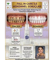 Diş Beyazlatma Jeli 75 ml - Anında Beyazlık Etkili Leke Karşıtı