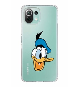 Xiaomi  Mi 11 Lite  Kamera Korumalı Kapak Donald Duck Tasarımlı Şeffaf  Kılıf