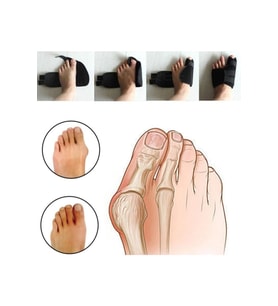 Halluks Valgus Ayak Başparmak Düzeltici Gece Ateli Ortopedik Kemik Çıkık Çıkıntısı Ateli (Siyah)