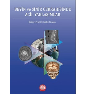 Beyin ve Sinir Cerrahisinde Acil Yaklaşımlar