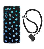 Xiaomi Mi 13 Lite Kılıf Resimli Boyun Askılı İpli Desenli Silikon Series Patiler 1858