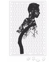 Garoto na Arvore Puzzle 240 Parça Yapboz