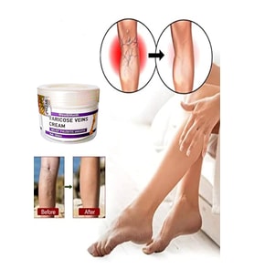 Varicose and Spider Veins Soothing Leg Cream 100 ml