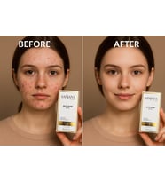 Sanjana Beauty Anti-Acne Serum 10 ml  Akne Karşıtı, Sivilce Kurutucu, Cilt Arındırıcı Serum