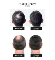 FONTENAY TOPİK KERATİN FIBERS AÇIK KAHVE TOPİK
