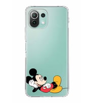 Xiaomi  Mi 11 Lite  Kamera Korumalı Kapak Mickey Mouse Tasarımlı Şeffaf  Kılıf