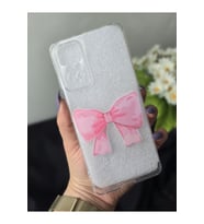Xiaomi Redmi NOTE 11S - NOTE 11 Uyumlu Baskılı Şeffaf Telefon Kılıfı