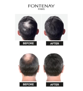 FONTENAY TOPİK KERATİN FIBERS KOYU KAHVE TOPİK