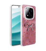Xiaomi Redmi Note 14 Pro Plus Uyumlu Kılıf Kamera Korumalı Figürlü Zore Ponti Silikon Kapak
