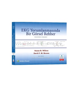 EKG Yorumlamasında Bir Görsel Rehber