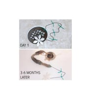 Evgereçlerim Drain Wig Lavabo Tıkanma Önleyici