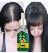 7Days 30ML Gingergerminalessentialoil Hair Growth Loss Treatment Serum Unisex 3 Adet Saç Bakım Yağı