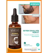 Seyrek Sakal Ve Köselik Için Güçlendirici Sakal & Bıyık Yağı  Dolgunlaştırıcı & Canlandırıcı Bakım