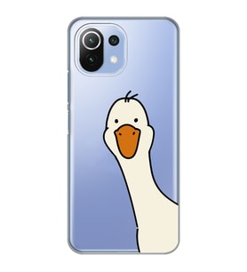 Xiaomi Mi 11 Lite Uyumlu Sevimli Ördek Desenli Şeffaf Telefon Kılıfı